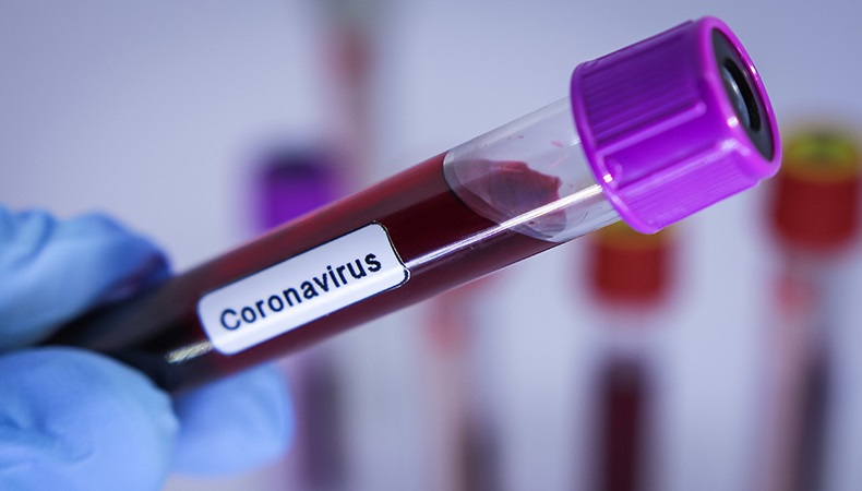 Suspeitas de novo coronavírus em MS sobem para 14