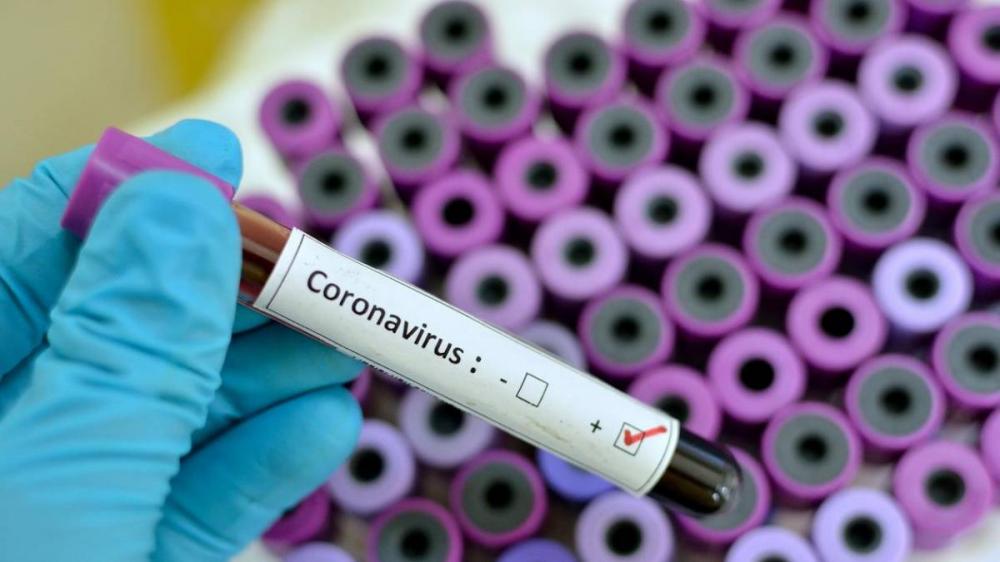 MS têm seis novos casos; 121 confirmados e 30 suspeitos do novo coronavírus