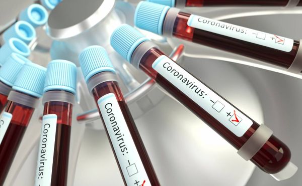 MS receberá nova máquina de testagem de Covid-19