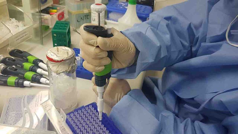 Saúde confirma 2 casos de reinfecção por covid em MS; um deles é de jovem de 19 anos
