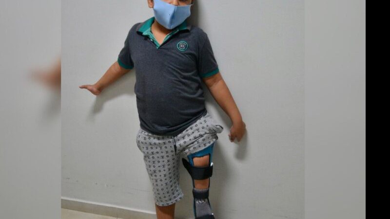 Menino de 7 anos comemora prótese com desenhos do Mickey e corre pelos corredores da APAE MS