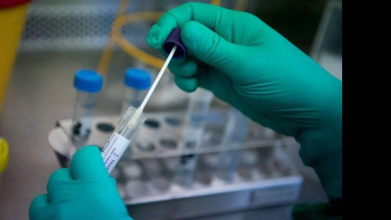 Covid-19: Brasil tem 19,7 milhões de casos e 551,8 mil mortes