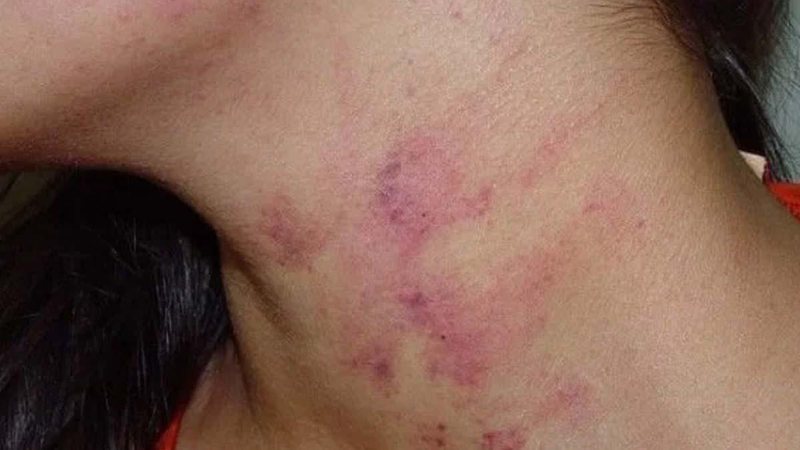 Após ser espancada, mulher vai à delegacia e é ameaçada enquanto registra ocorrência em MS