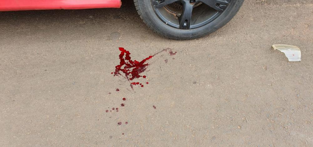 Bebê sai correndo de portão e acaba atropelado por carro em Costa Rica