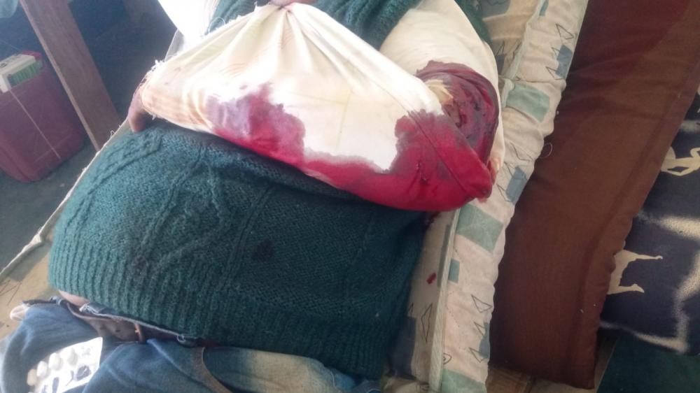 Homem com fratura no braço em fazenda no Pantanal é socorrido de avião pelos bombeiros