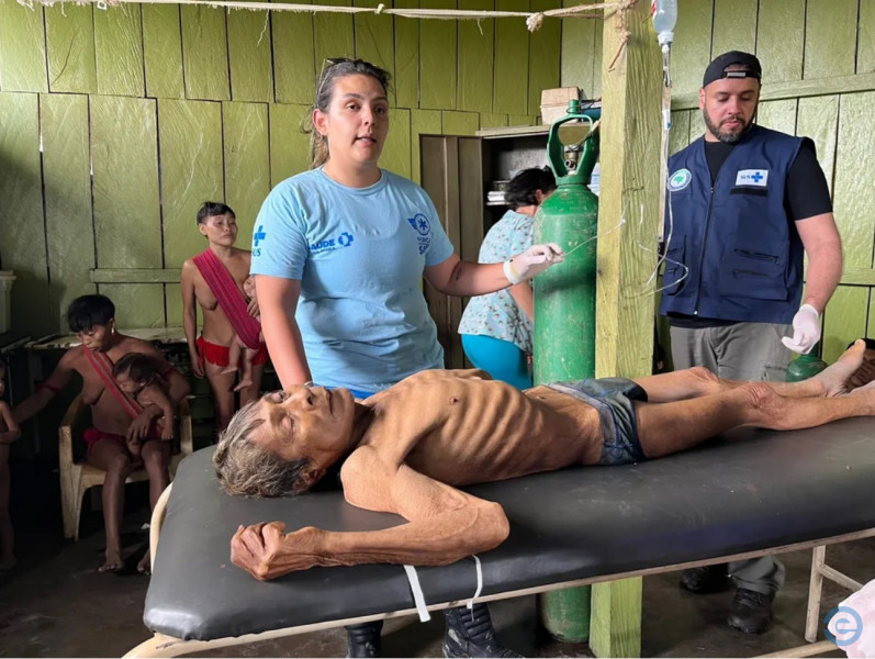 Yanomâmi que teve foto divulgada morre por grave quadro de desnutrição