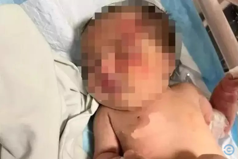 Bebê abandonada é encontrada em sacola carregada por cachorro