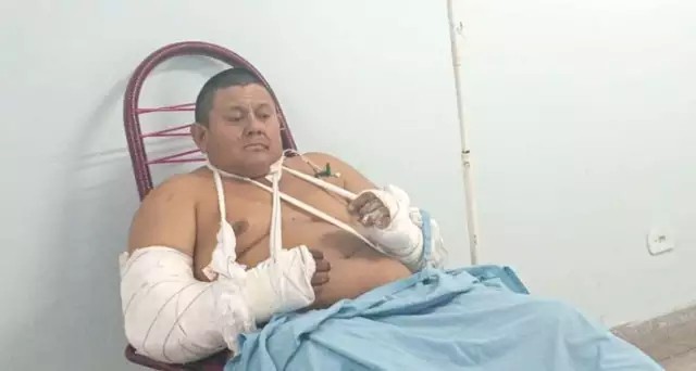 A três dias de aniversário, trabalhador atacado por onça diz que “nasceu de novo”