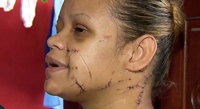 Mulher é atacada com golpes de faca por dono da casa após barulho, em Barueri - SP