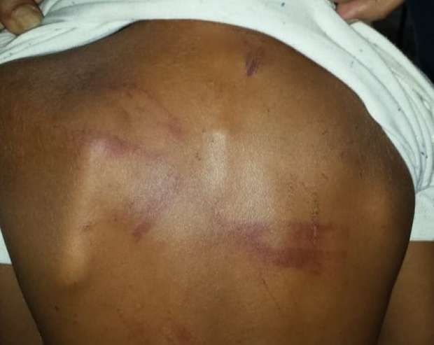 Mãe é presa por queimar e torturar filho de quatro anos em Ladário
