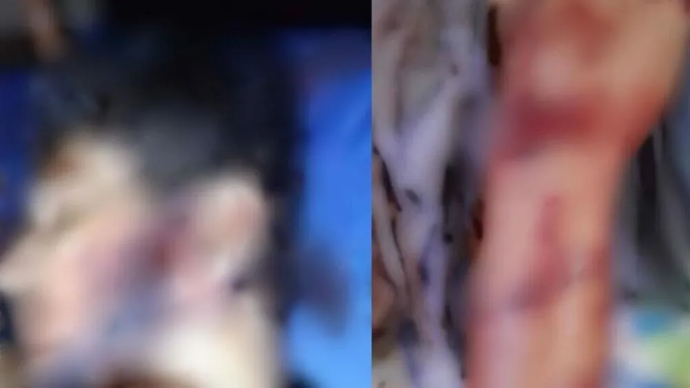 ‘Um milagre’: como peão se salvou do ataque brutal de onça-pintada em Mato Grosso do Sul?