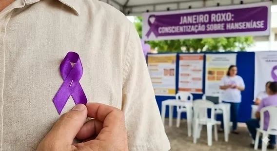 Janeiro Roxo: Governo de MS reforça combate à hanseníase com qualificação estadual sobre sinais e diagnóstico precoce