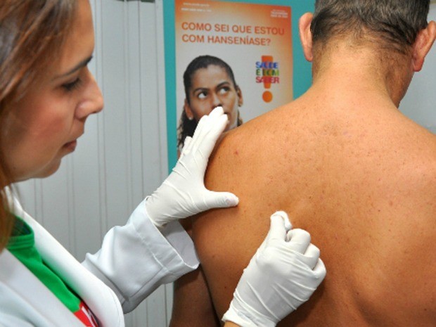 Dia Mundial da Hanseníase destaca importância do tratamento