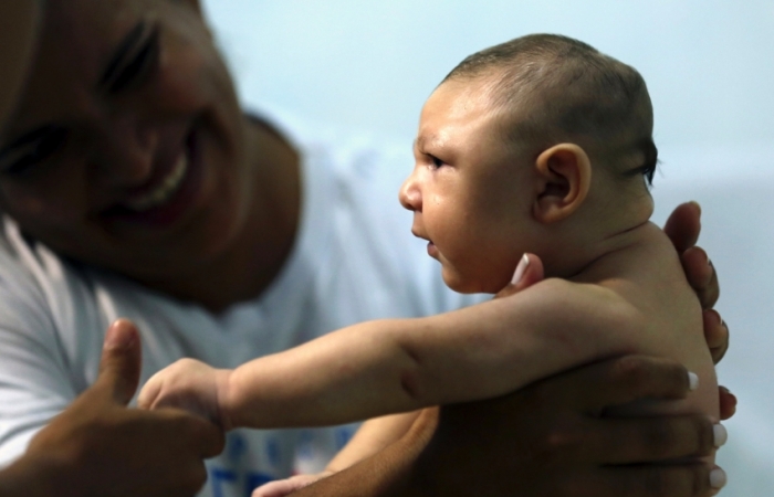 Senado aprova ampliação de pensão a crianças afetadas pelo vírus zika